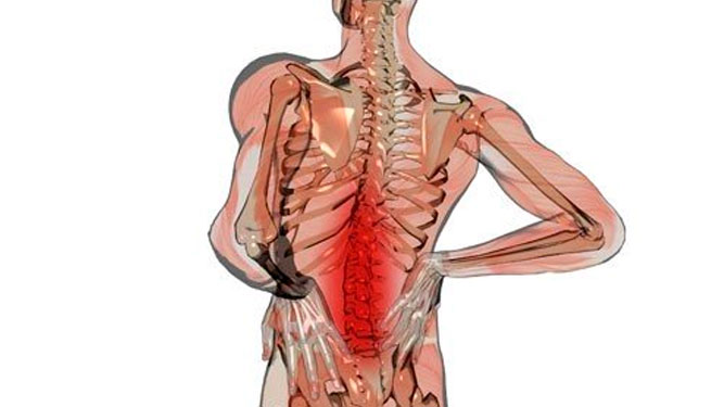 Dolor Lumbar