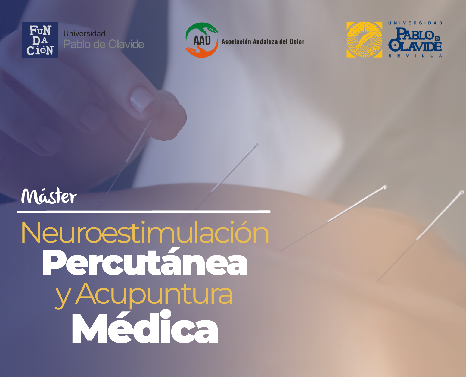 Máster de Formación Permanente Neuroestimulación Percutánea y Acupuntura Médica II Ed.